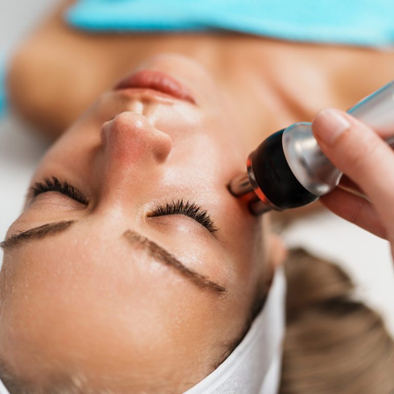 RF Treatment to tighten facial skin