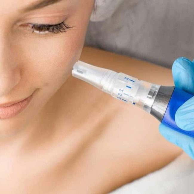 Skinpen Microneedling Treatment